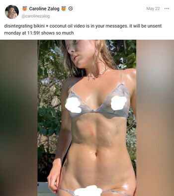 🔥 Caroline zalog  page leaked private photo uncensored full