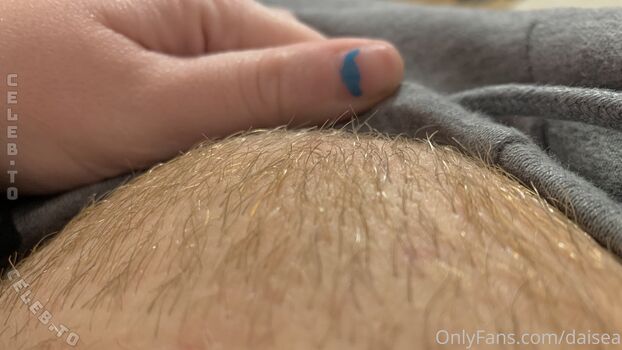 🔥 Daisea page leaked private photo uncensored full