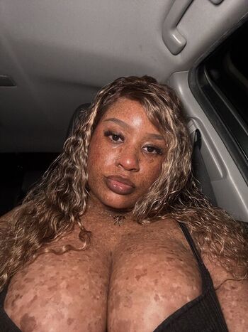🔥 Freckledn leaked private photo uncensored full