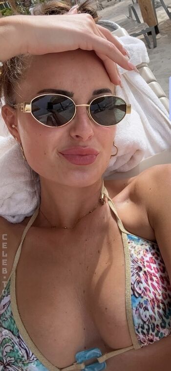 🔥 Gretalck page leaked private photo uncensored full