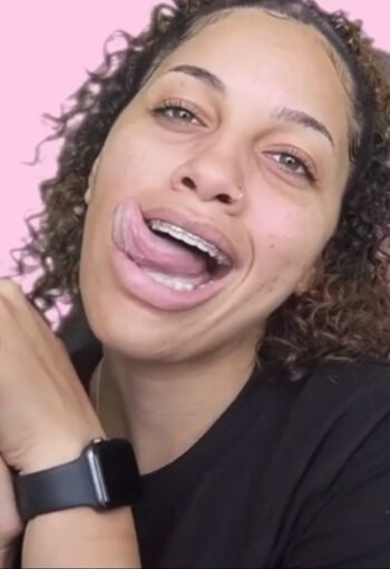 🔥 Lightskin  page leaked private photo uncensored full