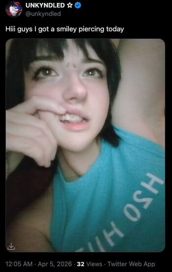 🔥 Unkyndled page leaked private photo uncensored full