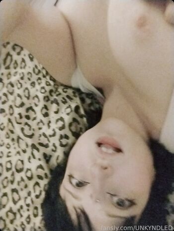 🔥 Unkyndled leaked private photo uncensored full